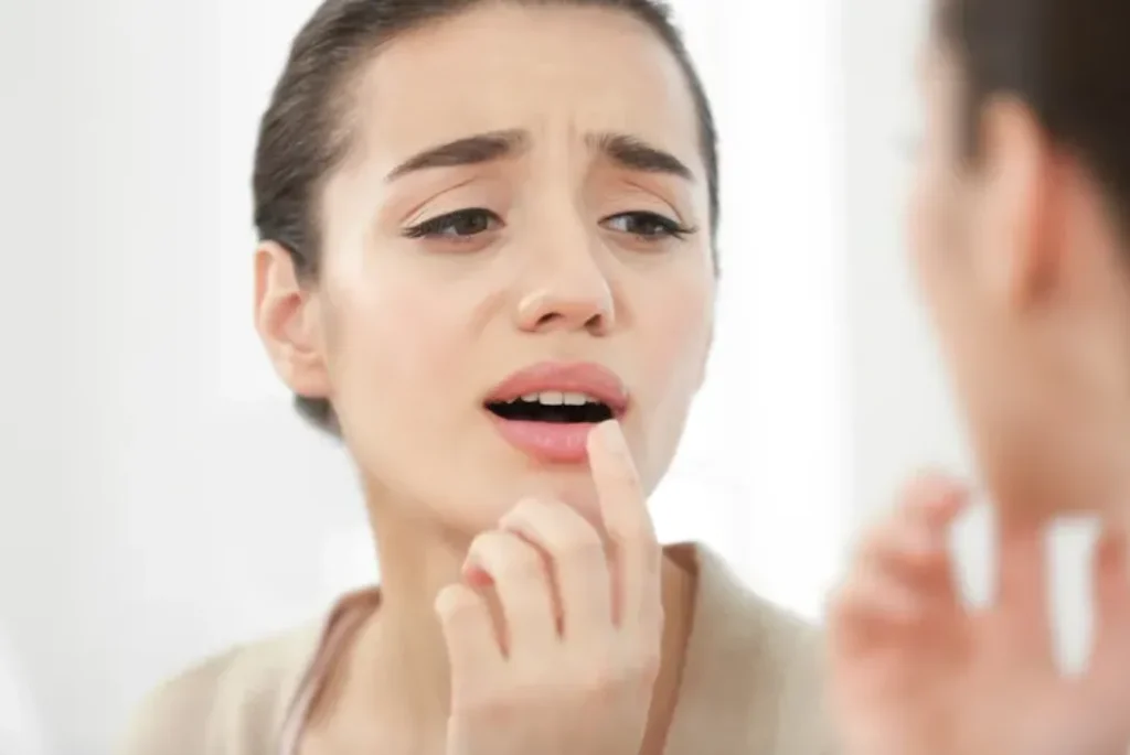 Fast Relief and Healing Solutions for Cold Sore